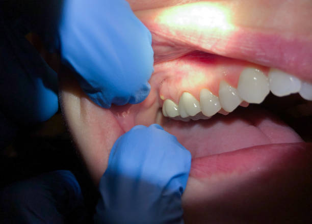Best Emergency Dentist Near Me  in Califon, NJ